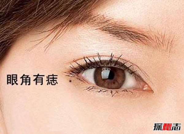 哪些痣必须点掉?必须取的十大凶痣(图解)